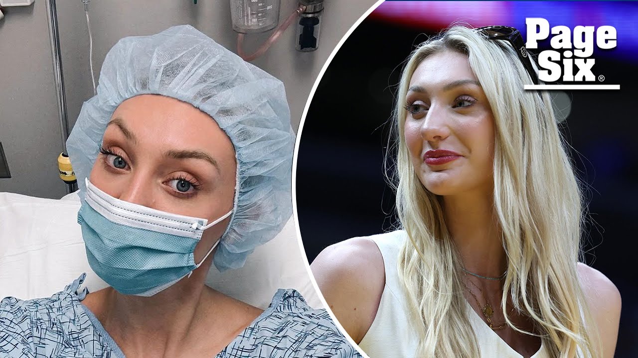 Cameron Brink reacts to fans who think she’s wearing full face of makeup after ACL surgery