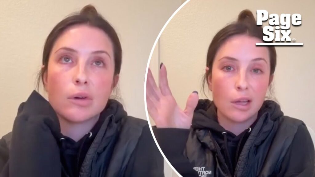 ‘Worried’ Bristol Palin reveals facial paralysis from neurological disorder ‘brought on by stress’