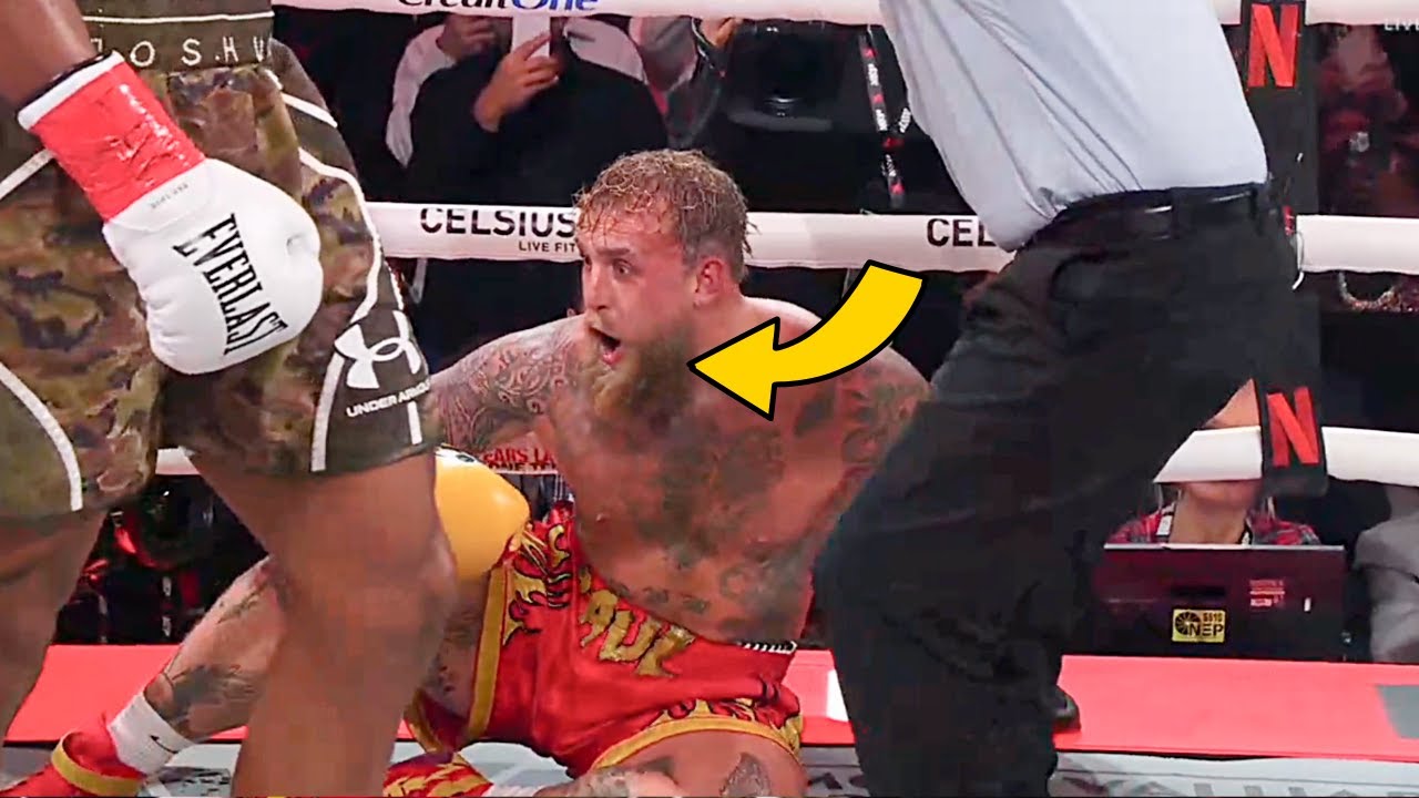 Jake Paul Stunned After Jaw Gets Broken by Anthony Joshua – Doctor Explains