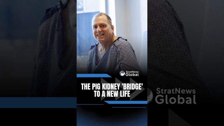 A Pig kidney bought a dying man nine months of life | #shorts #TimAndrews #pigkidney